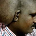 Homem retira tumor cerebral de 11 kg, considerado o maior da história