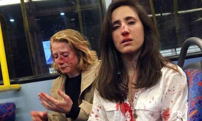 Namoradas são agredidas em Londres após homens exigirem que se beijassem: 'Como se fôssemos um espet...