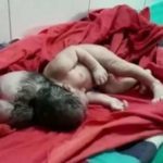 Pai tenta enterrar bebê que nasceu com três cabeças ainda vivo