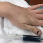 Mulher fica com o sangue azul após tomar remédio para dor de dente