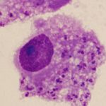 Novo parasita que já infectou mais de cem pessoas no Nordeste é identificado