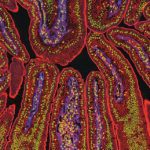 Destaques de estudos sobre o microbioma intestinal