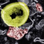 Eliminando bactérias resistentes com nanopartículas