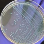 Cientistas de alimentos criam atlas nacional para listeria mortal