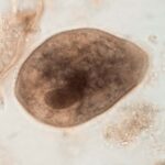 Parasitologia: Balantidiose - Balantidium coli