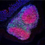 Adicionar um único tipo de bactéria ao microbioma intestinal aumentou a imunidade antitumoral em cam...
