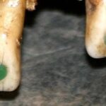 Antiga prática maia de colar pedras preciosas nos dentes pode ter sido mais do que estética