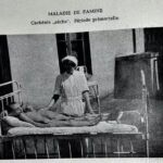Médicos judeus relataram secretamente efeitos das políticas de fome nazistas