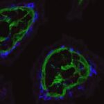 A patrulha intestinal: um novo olhar fascinante sobre o que leva as células T a proteger os intestin...