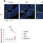 Fitoterápico japonês protege o intestino contra doenças inflamatórias intestinais