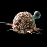 Esta terapia Crispr personalizada é projetada para atacar tumores