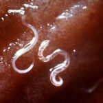 Como os vermes desenvolvem seu intestino?