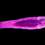 Parasitologia: Fasciola hepatica