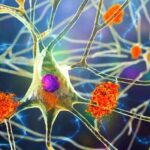 Estudo de 500.000 registros médicos liga vírus à doença de Alzheimer diversas vezes