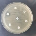 Surgimento de cepa Shigella sonnei extensivamente resistente a drogas na França