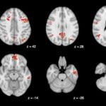 A poluição do trânsito prejudica a função cerebral