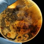 Como as bactérias desenvolvem resistência aos antibióticos