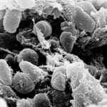 DNA de peste de 4.000 anos encontrado na Grã-Bretanha
