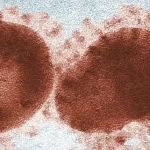 AI pode ser capaz de nos avisar antes da próxima pandemia
