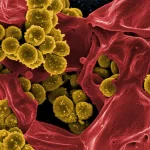 Novo antibiótico que mata superbactérias descoberto em micróbios de “matéria escura” do solo da Caro...