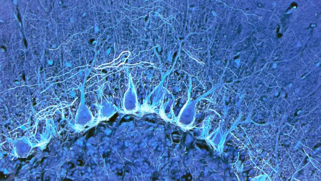 Foto de microscopia de células de Purkinje que são grandes neurônios encontrados no cerebelo