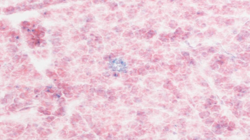 textura rosa e branca com pontos azuis, imagem de microscopia de amostras de tecido pancreático de um camundongo