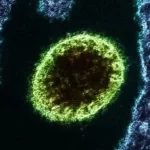 Vírus Nipah, existe risco de uma nova pandemia?