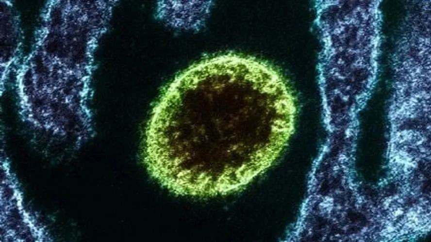 círculo verde, um vírus isolado Nipah observado em laboratório