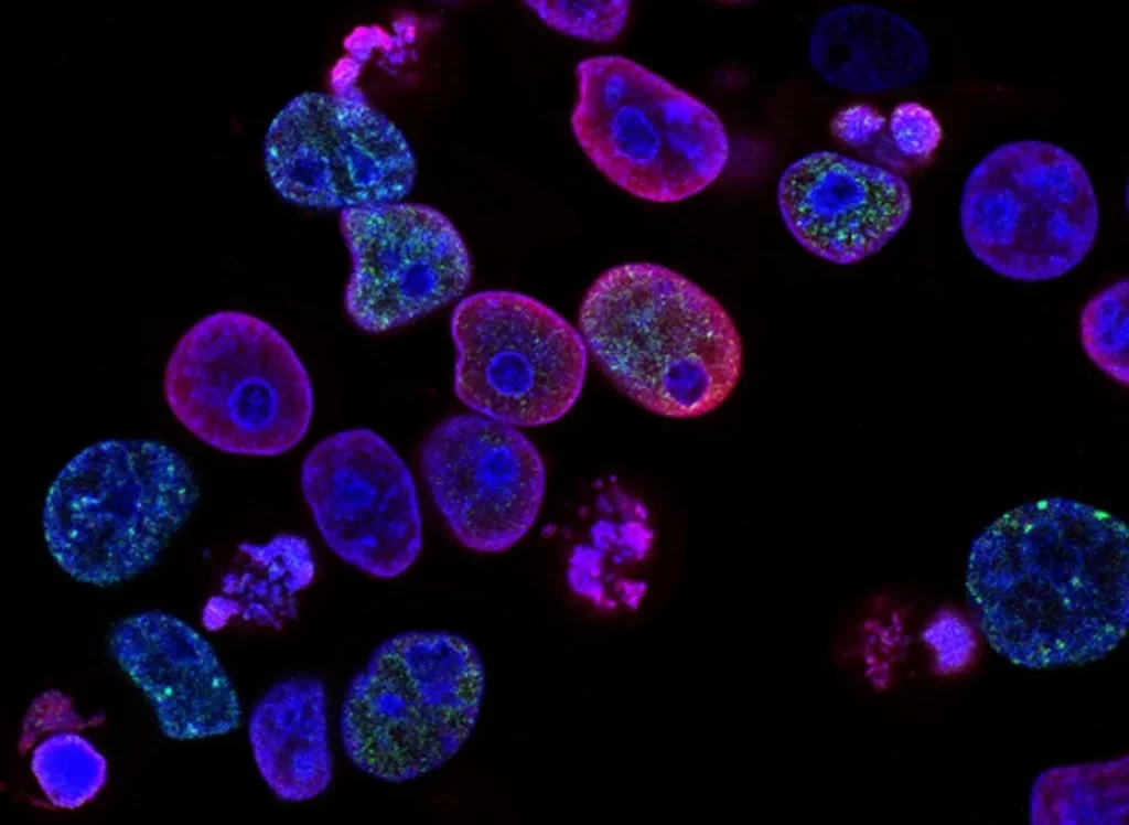 imagem de microscopia de fundo escuro com células cancerígenas coloridas de azul, rosa, roxo, violeta e verde