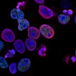 Microplásticos podem se acumular nas células cancerígenas e podem ajudá-las a se espalhar, sugere es...
