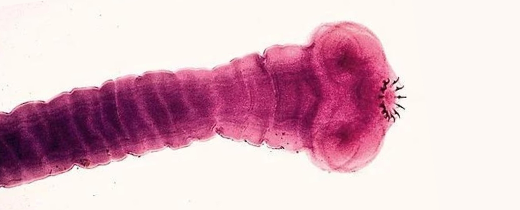 imagem de microscópio da cabeça de uma taenia solium em tons vermelhos e rosados