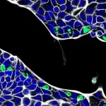 A clamídia pode se esconder no intestino e causar infecções repetidas