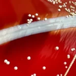 Qual é a diferença entre bactérias gram-positivas e gram-negativas?
