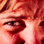 O caso raro da mulher que começou a suar sangue pelo rosto e pelas mãos