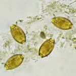 Parasita nunca antes visto é resistente à ivermectina
