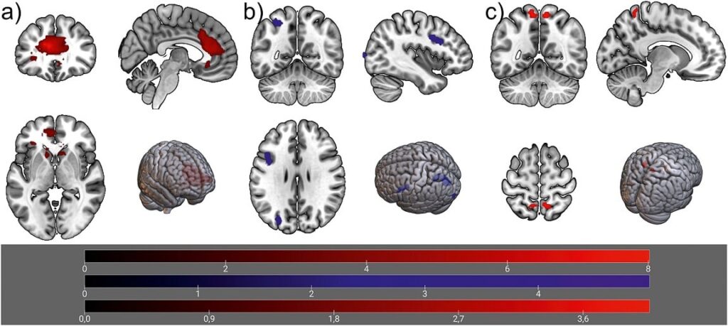 Imagens de atividade cerebral relacionada a CR ao longo do tempo