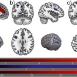 Restrição de smartphones por três dias pode alterar atividade cerebral