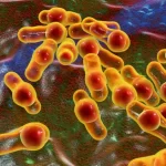 Infecção mortal de um homem foi desencadeada por um suplemento probiótico