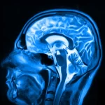 Mulher americana morre de doença de príon — após receber uma injeção infectada 50 anos antes