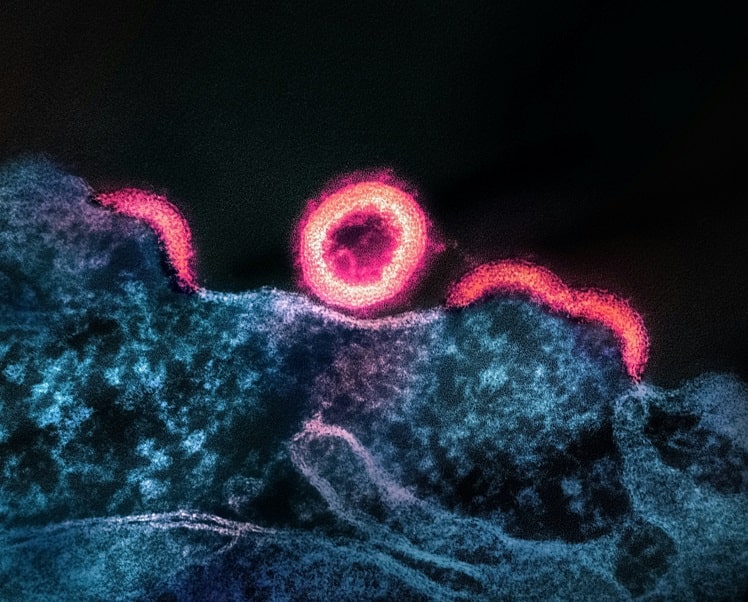 microscopia de microrganismo