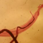 Este verme parasita pode desligar sua capacidade de sentir dor