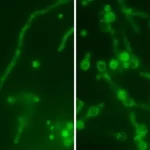 O vírus da 'boneca russa' se esconde dentro de um fungo mortal, tornando-o ainda mais perigoso para ...