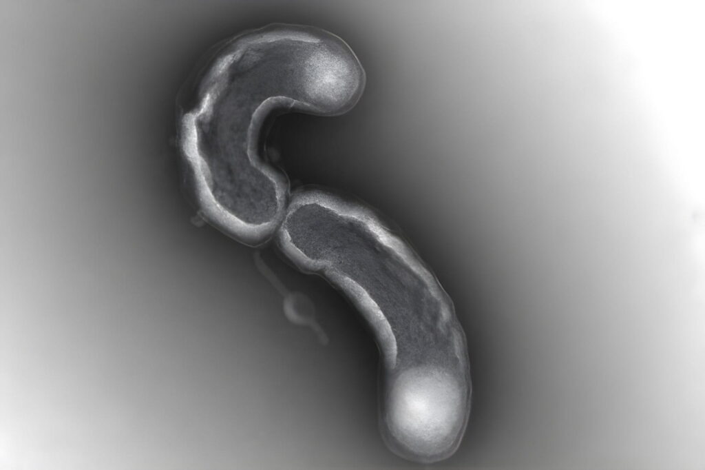 A microscopia eletrônica de transmissão (MET) foi realizada em células LSUCC0530 cultivadas até a fase exponencial tardia. Uma análise de centenas de genomas de SAR11 revelou que alterações em seu ambiente levaram à divisão celular anormal.
