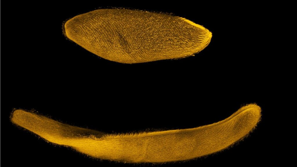Spirostomum ambíguo.