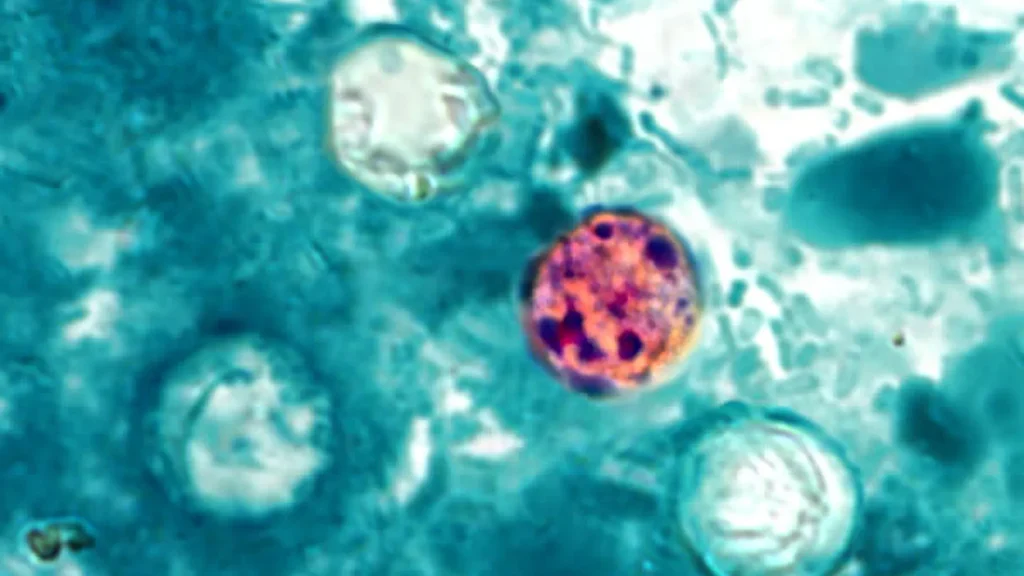 Imagem microscópica de quatro oocistos de Cyclospora cayetanensis em uma amostra de fezes corada contra um fundo azul-esverdeado, visualizada usando uma coloração ácido-resistente modificada.